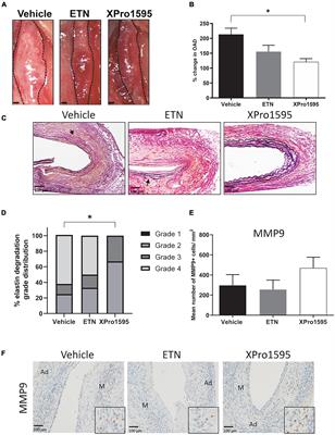 Selective inhibition of soluble tumor necrosis factor signaling reduces abdominal aortic aneurysm progression